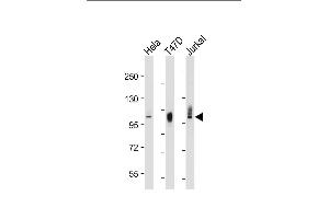 All lanes : Anti-LP2 Antibody at 1:2000-8000 dilution Lane 1: HeLat whole cell lysate Lane 2: T47D whole cell lysate Lane 3: Jurkat whole cell lysate Lysates/proteins at 20 μg per lane. (LAMP2 antibody)