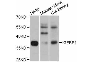 Western blot analysis of extracts of various cell lines, using IGFBP1 antibody. (IGFBPI antibody)