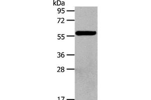 Western Blot analysis of Hela cell using HDAC7 Polyclonal Antibody at dilution of 1:100 (HDAC7 antibody)