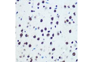 Immunohistochemistry of paraffin-embedded mouse brain using hnRNP K Rabbit mAb (ABIN7267634) at dilution of 1:100 (40x lens). (HNRNPK antibody)
