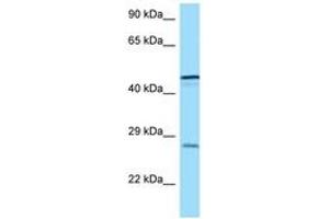 Image no. 1 for anti-Triggering Receptor Expressed On Myeloid Cells 1 (TREM1) (AA 162-211) antibody (ABIN6748121) (TREM1 antibody  (AA 162-211))