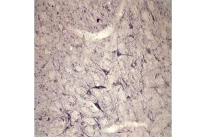 IHC on rat spinal cord using Rabbit antibody to extracellular, N-terminal part of Sortilin (Neurotensin receptor 3, NTR3, Sort1): IgG  at a concentration of 10 µg/ml. (Sortilin 1 antibody)