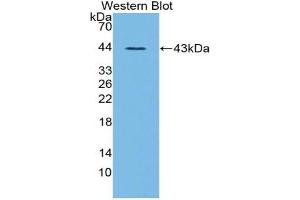 Western blot analysis of the recombinant protein. (Ghrelin antibody  (AA 28-117))