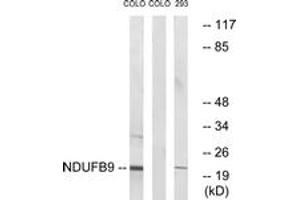 Western Blotting (WB) image for anti-NADH Dehydrogenase (Ubiquinone) 1 beta Subcomplex, 9, 22kDa (NDUFB9) (AA 102-151) antibody (ABIN2890437) (NDUFB9 antibody  (AA 102-151))