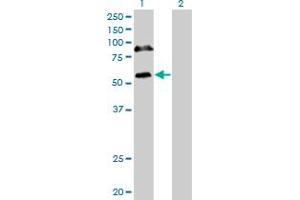 Western Blot analysis of RBM6 expression in transfected 293T cell line by RBM6 monoclonal antibody (M16), clone 4B3.