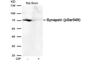 Western blot analysis of extracts from Rat brain tissue or calf intestinal phosphatase (CIP), using Synapsin (phospho-Ser549) Antibody. (SYN1 antibody  (pSer549))