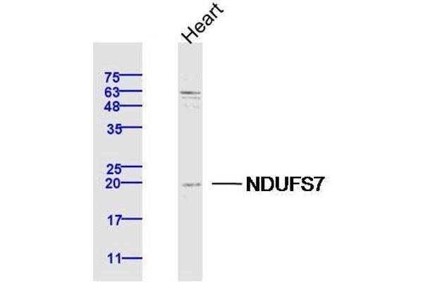 NDUFS7 antibody  (AA 101-160)