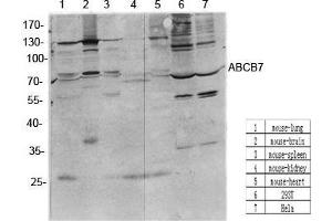 Western Blot (WB) analysis of specific cells using antibody diluted at 1:1000. (ABCB7 antibody  (C-Term))