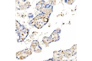Immunohistochemistry of paraffin-embedded Human placenta using IGF1 antibody (ABIN1682184, ABIN3015345, ABIN3015346 and ABIN7101347) at dilution of 1:100 (40x lens). (IGF1 antibody)
