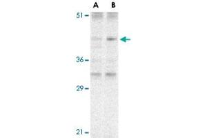 Western blot analysis of CARD8 expression in K-562 cell lysate with CARD8 polyclonal antibody  at (A) 2 and (B) 4 ug /mL . (CARD8 antibody  (C-Term))