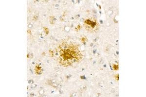 Immunohistochemistry analysis of paraffin embedded mouse Alzheimer',s brain using Aβ40 (ABIN7073042) at dilution of 1:1000 (Abeta 1-40 antibody)