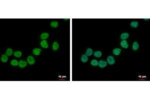 ICC/IF Image ZNF45 antibody [N2C3] detects ZNF45 protein at nucleus by immunofluorescent analysis. (ZNF45 antibody)