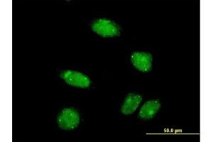 Immunofluorescence of monoclonal antibody to PIAS2 on HeLa cell. (PIAS2 antibody  (AA 385-473))