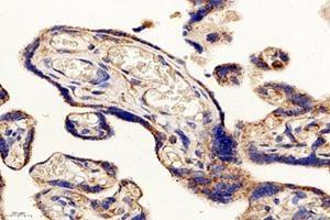 Immunohistochemistry analysis of paraffin-embedded human placenta using,PSMD8 (ABIN7075226) at dilution of 1: 2600