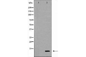 Western blot analysis of extracts of THP-1 , using CSTA antibody. (CSTA antibody  (C-Term))