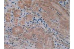 IHC-P analysis of Mouse Kidney Tissue, with DAB staining. (TCF20 antibody  (AA 1871-1965))