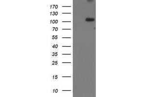 HEK293T cells were transfected with the pCMV6-ENTRY control (Left lane) or pCMV6-ENTRY ERCC4 (Right lane) cDNA for 48 hrs and lysed. (ERCC4 antibody)