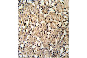 Formalin-fixed and raffin-embedded mouse kidney reacted with X8 Antibody (Center), which was peroxidase-conjugated to the secondary antibody, followed by DAB staining. (PAX8 antibody  (AA 285-313))