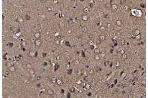 anti-Profilin 2 (PFN2) (AA 96-138) antibody