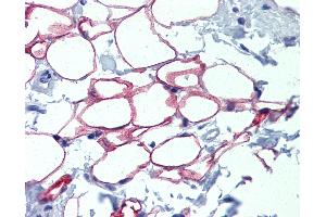 Anti-NFIC antibody IHC of normal human adrenal (adipocytes). (NFIC antibody  (AA 323-372))