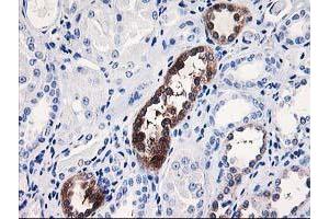 Immunohistochemical staining of paraffin-embedded Human Kidney tissue using anti-NUBPL mouse monoclonal antibody. (NUBPL antibody  (AA 1-250))