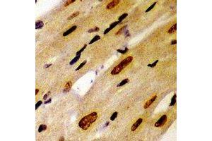 Immunohistochemical analysis of PSMC2 staining in mouse heart formalin fixed paraffin embedded tissue section. (PSMC2 antibody)
