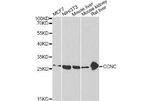 Western blot analysis of extracts of various cell lines, using CCNC antibody (ABIN2561645) at 1:1000 dilution. (Cyclin C antibody)