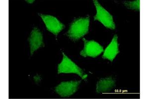 Immunofluorescence of purified MaxPab antibody to DNMBP on HeLa cell. (DNMBP antibody  (AA 1-823))