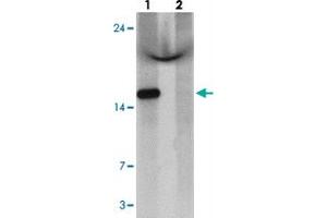 Western blot analysis of C1orf64 in HeLa cell lysate with C1orf64 polyclonal antibody  at 1 ug/mL in (lane 1) the absence and (lane 2) the presence of blocking peptide. (C1orf64 antibody  (C-Term))