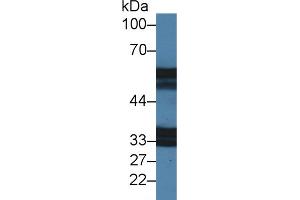 Western Blot; Sample: Mouse Stomach lysate; Primary Ab: 2µg/ml Rabbit Anti-Mouse IL18R1 Antibody Second Ab: 0. (IL18R1 antibody  (AA 391-518))