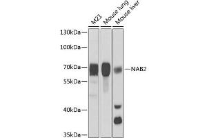 Western blot analysis of extracts of various cell lines, using N antibody  at 1:1000 dilution. (NAB2 antibody  (AA 1-200))