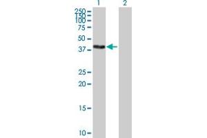 Western Blot analysis of ZSCAN16 expression in transfected 293T cell line by ZSCAN16 MaxPab polyclonal antibody. (ZSCAN16 antibody  (AA 1-348))