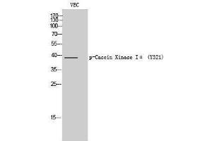 Western Blotting (WB) image for anti-Casein Kinase 1, alpha 1 (CSNK1A1) (pTyr321) antibody (ABIN3182288) (CSNK1A1 antibody  (pTyr321))