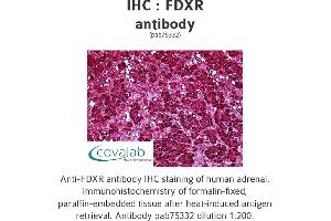 Image no. 2 for anti-Ferredoxin Reductase (FDXR) antibody (ABIN1734312) (Ferredoxin Reductase antibody)