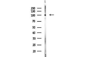 anti-EPH Receptor B4 (EPHB4) (C-Term) antibody