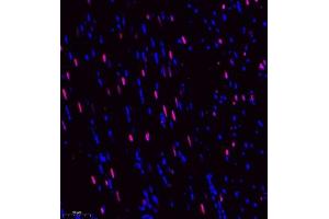 Immunofluorescence of paraffin embedded rat heart using DEPDC1 (ABIN7073717) at dilution of 1:500 (250x lens) (DEPDC1 antibody)