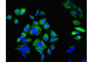 Immunofluorescence (IF) image for anti-Keratin 6A (KRT6A) (AA 2-564) antibody (ABIN7157433)