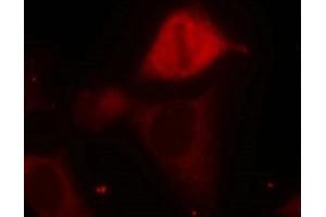 Immunofluorescence staining of methanol-fixed Hela cells using MKK3(Phospho-Ser189) Antibody. (MAP2K3 antibody  (pSer189))
