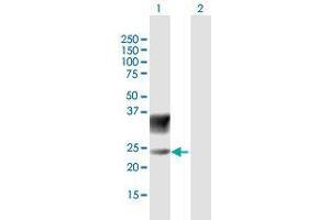 Western Blot analysis of SCN3B expression in transfected 293T cell line by SCN3B MaxPab polyclonal antibody. (SCN3B antibody  (AA 1-215))
