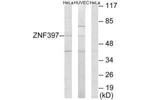 Western blot analysis of extracts from HeLa cells and HUVEC cells, using ZNF397 antibody. (ZNF397 antibody  (N-Term))