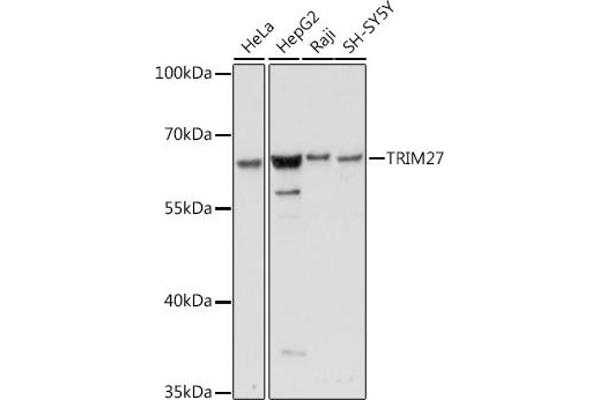 TRIM27 Antikörper  (AA 1-200)