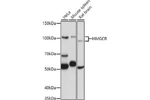 Western blot analysis of extracts of various cell lines, using HMGCR antibody (ABIN6132111, ABIN6141869, ABIN6141870 and ABIN6217262) at 1:1000 dilution. (HMGCR antibody  (AA 629-888))