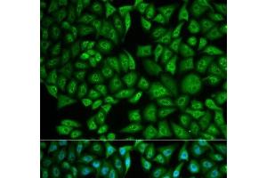 Immunofluorescence analysis of MCF-7 cells using CTSA Polyclonal Antibody (CTSA antibody)