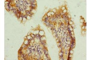 Immunohistochemistry of paraffin-embedded human small intestine tissue using ABIN7173293 at dilution of 1:100 (TMEM91 antibody  (AA 1-97))