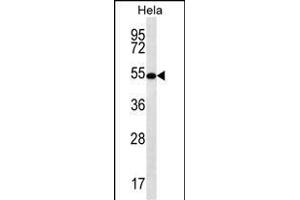 SCHIP1 Antibody (Center) (ABIN656782 and ABIN2846000) western blot analysis in Hela cell line lysates (35 μg/lane). (SCHIP1 antibody  (AA 90-118))
