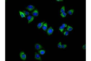 Immunofluorescence staining of Hela cells with ABIN7171862 at 1:100, counter-stained with DAPI. (Tetraspanin 18 antibody  (AA 151-223))