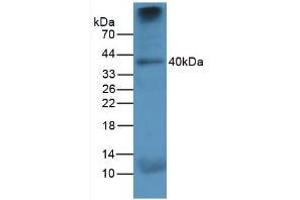 Figure. (Cathepsin K antibody  (AA 115-329))