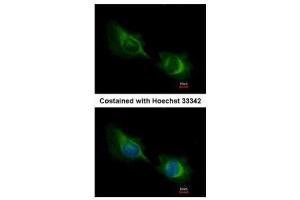 ICC/IF Image Immunofluorescence analysis of methanol-fixed HeLa, using Deltex1, antibody at 1:200 dilution. (Deltex Homolog 1 antibody  (Center))
