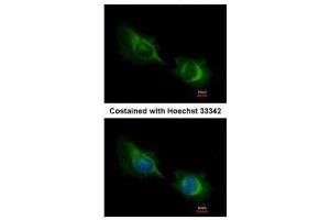 ICC/IF Image Immunofluorescence analysis of methanol-fixed HeLa, using Deltex1, antibody at 1:200 dilution.