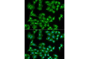 Immunofluorescence analysis of A549 cells using ELF3 antibody (ABIN5973778). (ELF3 antibody)